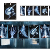 Guirnalda de radiografias de 3 m 16x22 cm